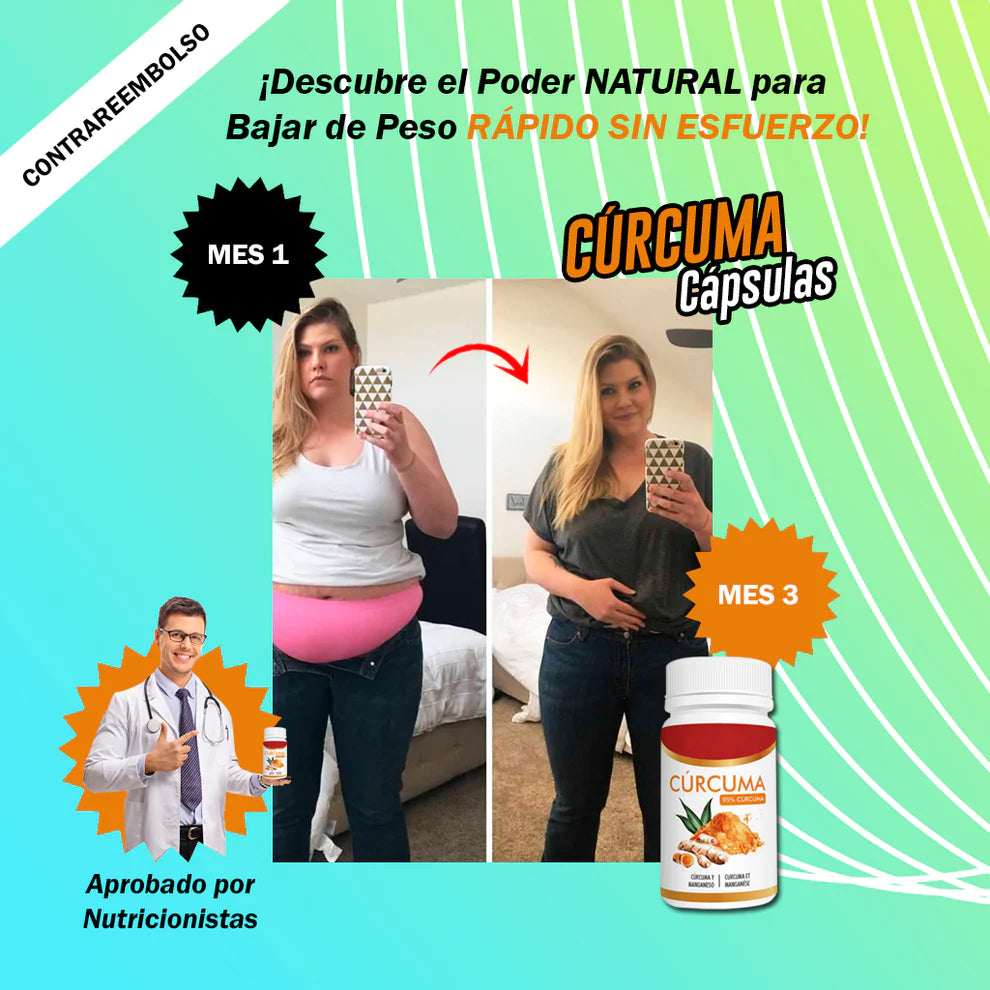 SUP Cúrcuma 30 Cápsulas – Apoyo Articular y Antioxidante Natural