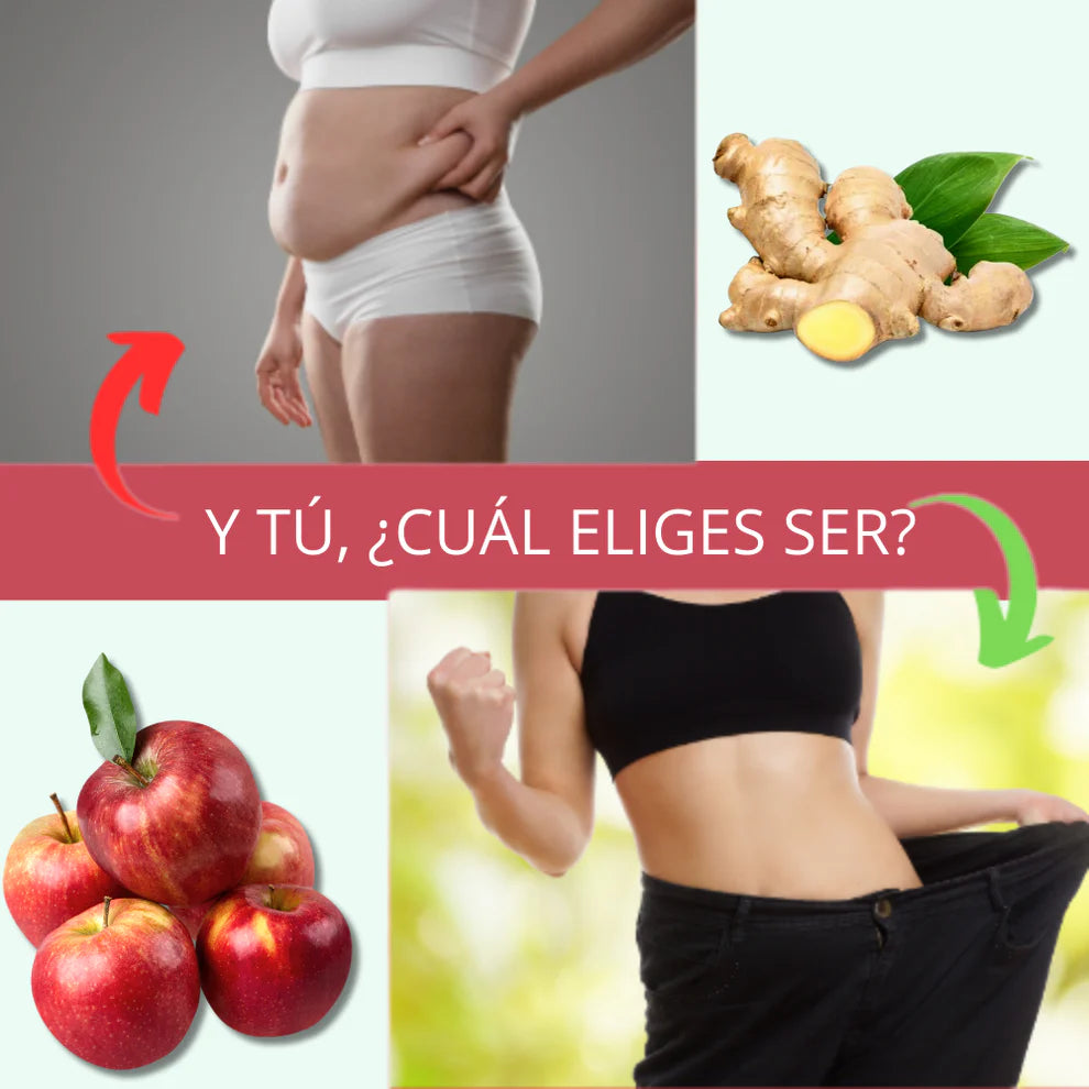 SUP Gummies de Vinagre de Manzana – Apoyo Digestivo y Energía Natural